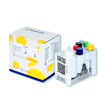 SmartEIA RSV IgM